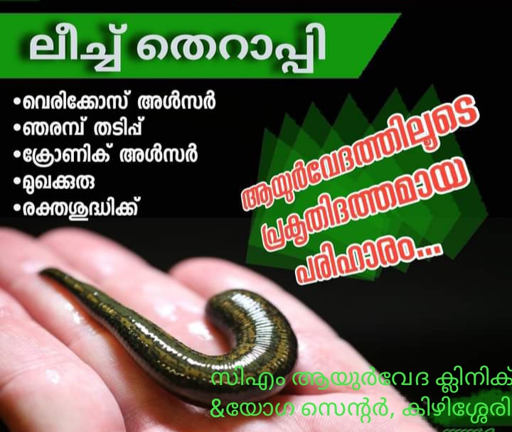 CM Ayur Treat